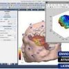 Software: Uma tela de computador exibe a interface MATLAB R2022a v9.12, apresentando um software de imagem cerebral 3D com várias opções de dados à esquerda e um modelo cerebral vibrante em uma janela separada à direita. Os rótulos na parte inferior destacam a entrega instantânea, ativação online, uma licença original e uma opção para comprar uma licença em nossa loja de software (comprar licença na nossa loja de software).