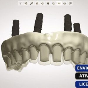 Software: Uma renderização digital de um modelo 3Shape Dental System - VITALÍCIO é exibida em uma tela, exibindo um design protético detalhado com parafusos. Sobreposições de texto destacam entrega instantânea, ativação online e licenciamento original — semelhante a comprar licença na sua loja de software preferida.